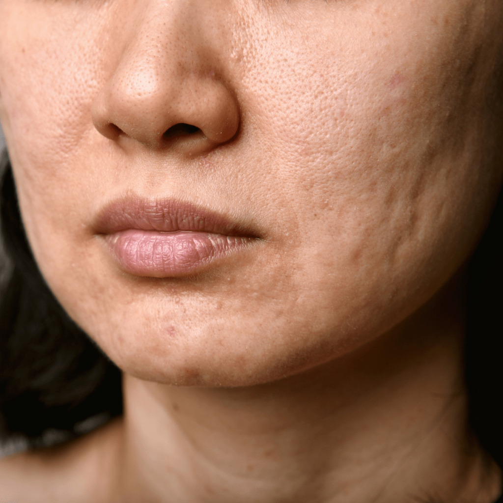 Close up of female face with damaged skin