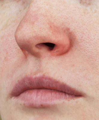 Close Up on Blonde Woman Nose And Lips