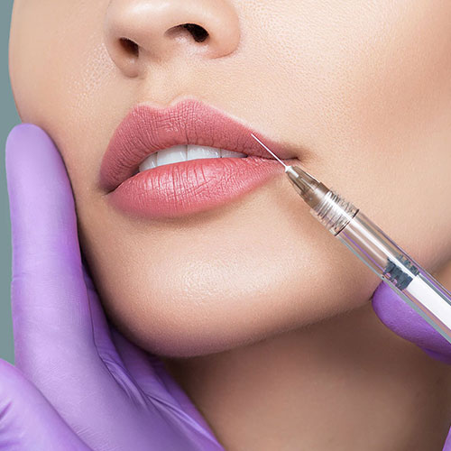 Lip Filler Injection Treatment