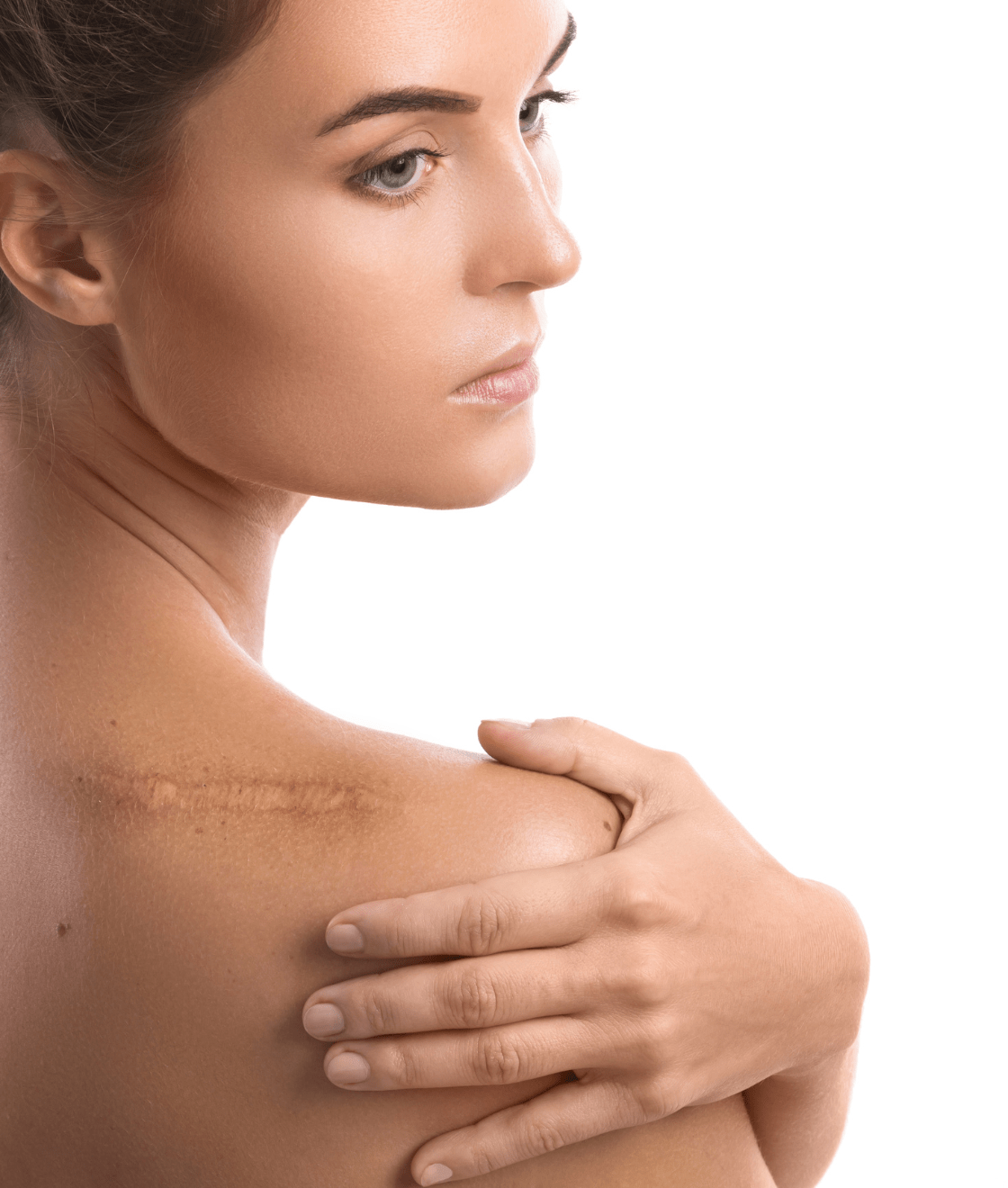 Beautiful woman with a scar on her shoulder