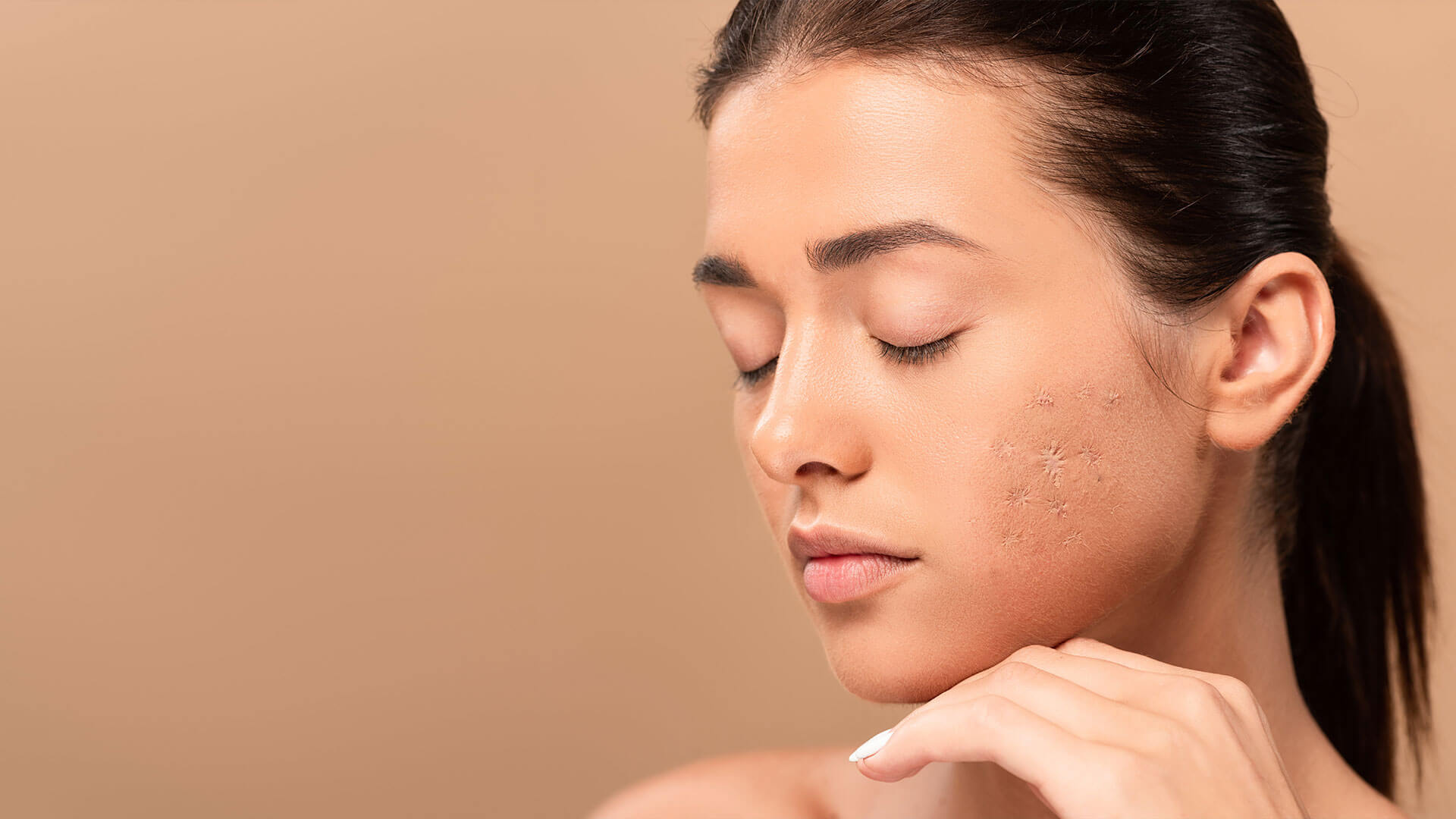 Scar Reduction