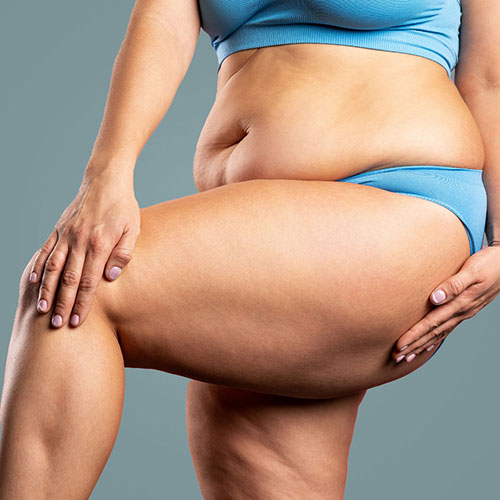 plus sized model showing off thighs