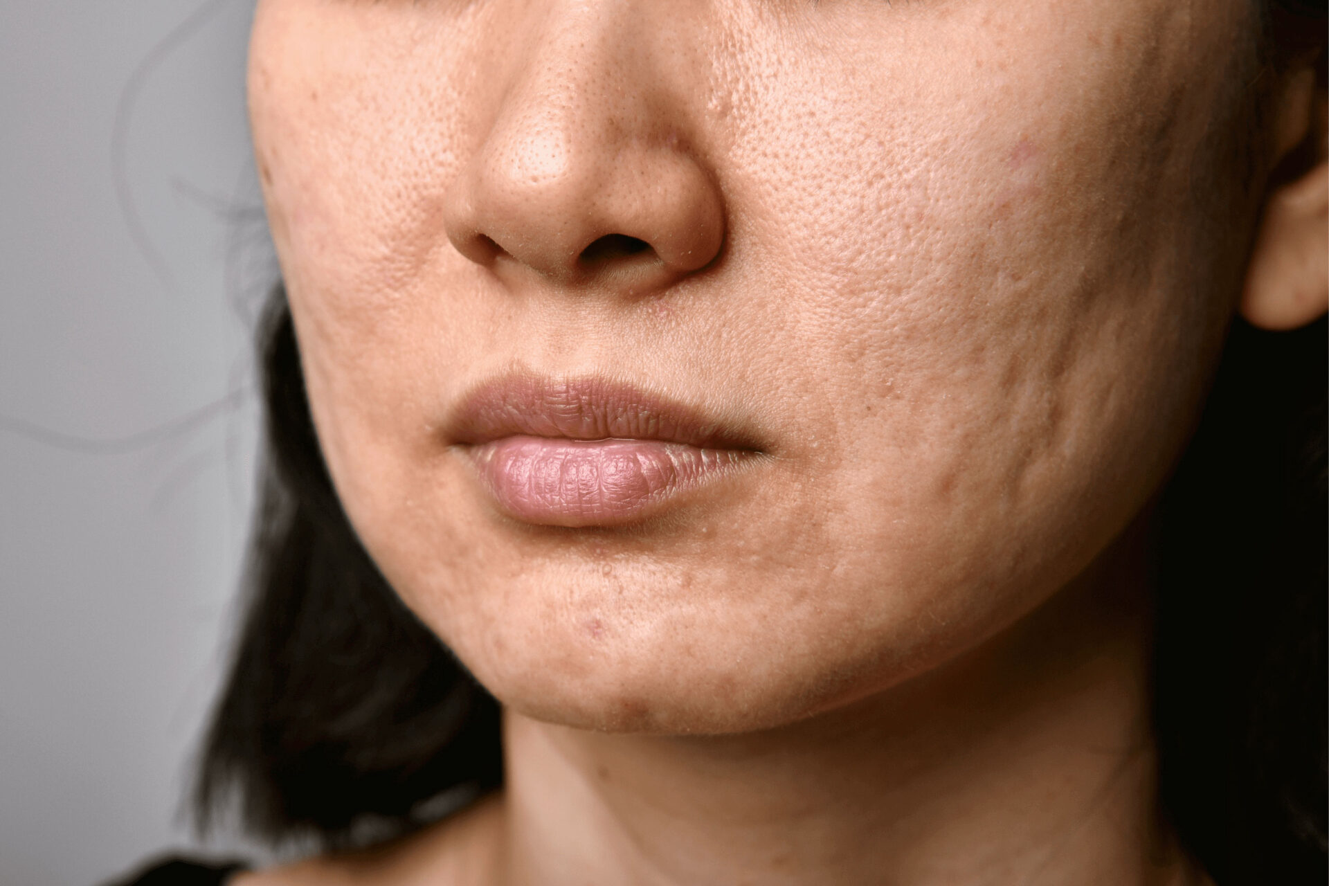 Close up of asian womans face, highlighting scarring