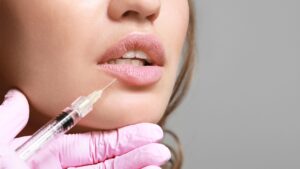Close-up of a cosmetic practitioner performing a lip filler injection for natural lip enhancement