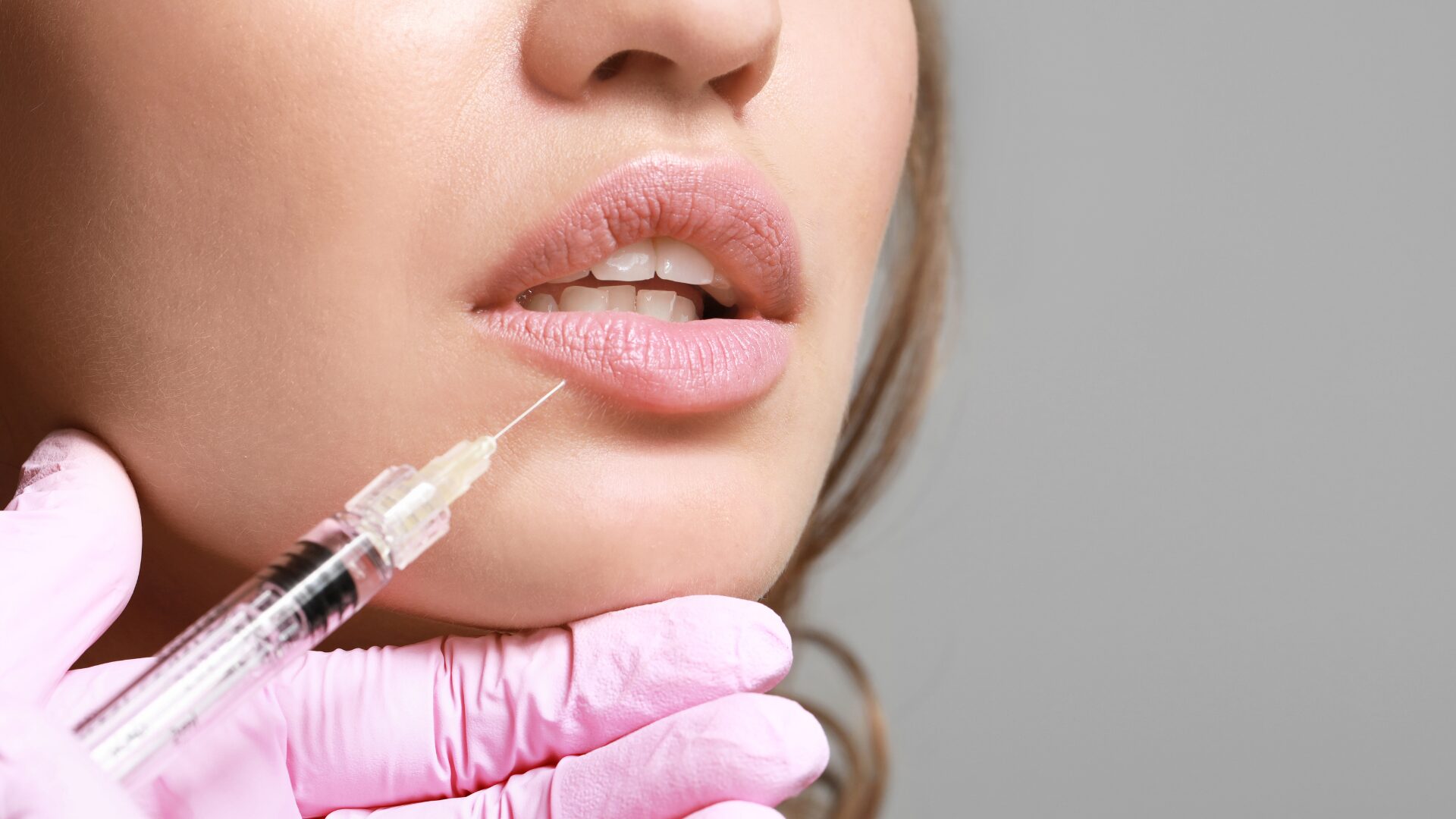 Close-up of a cosmetic practitioner performing a lip filler injection for natural lip enhancement